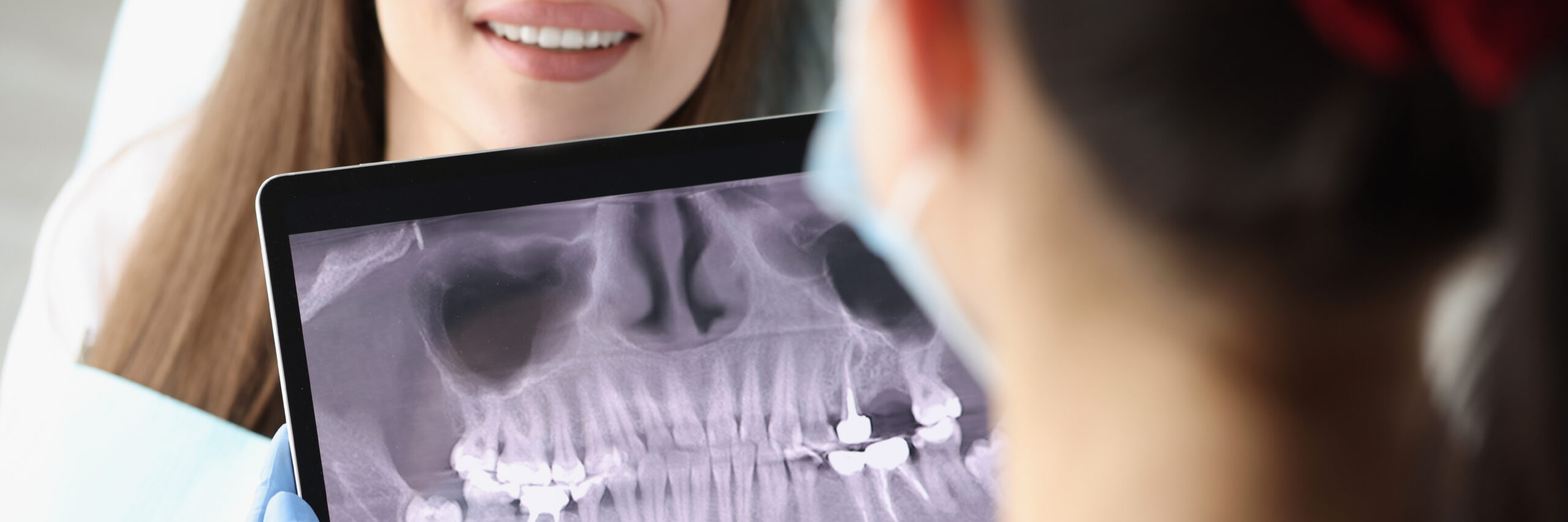 Zahnarzt prüft das Röntgenbild vor einer Implantatbehandlung